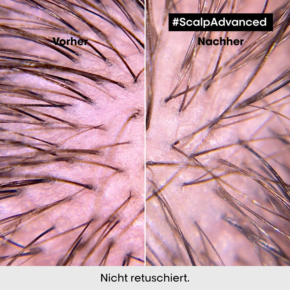 L'Oréal Professionnel Serie Expert Scalp Advanced Anti-Discomfort Intense Soother Treatment 200 ml